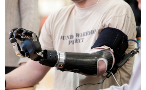 上肢假肢（手假肢）的日常康复训练方法