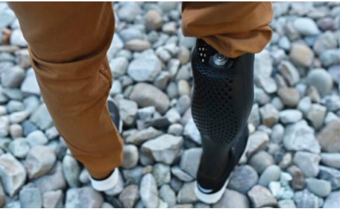 假肢在使用过程中要注意勤清洁