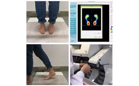 常见足部病变的矫形鞋垫康复与护理（二）