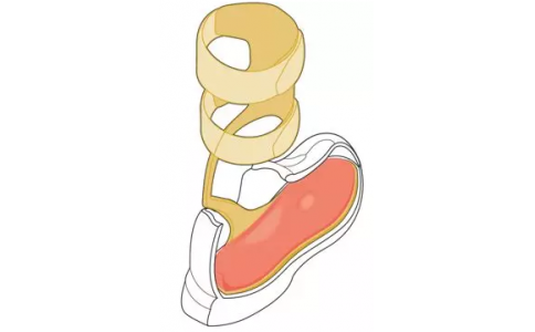 WalkOn Reaction碳纤膝踝稳定矫形器