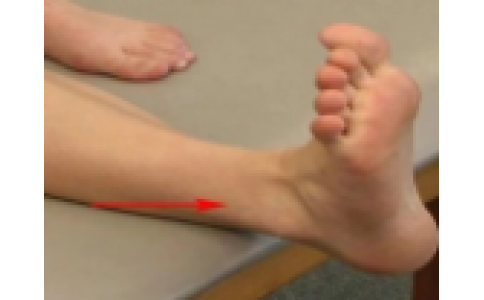 足踝扭伤完整解析 - 骨科基础