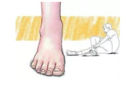 针刺篇 - 踝扭伤结构细解